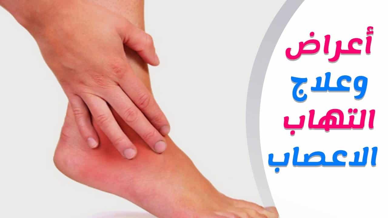 مرض الاعصاب النفسي - معلومات عن مرض الاعصاب 321 2