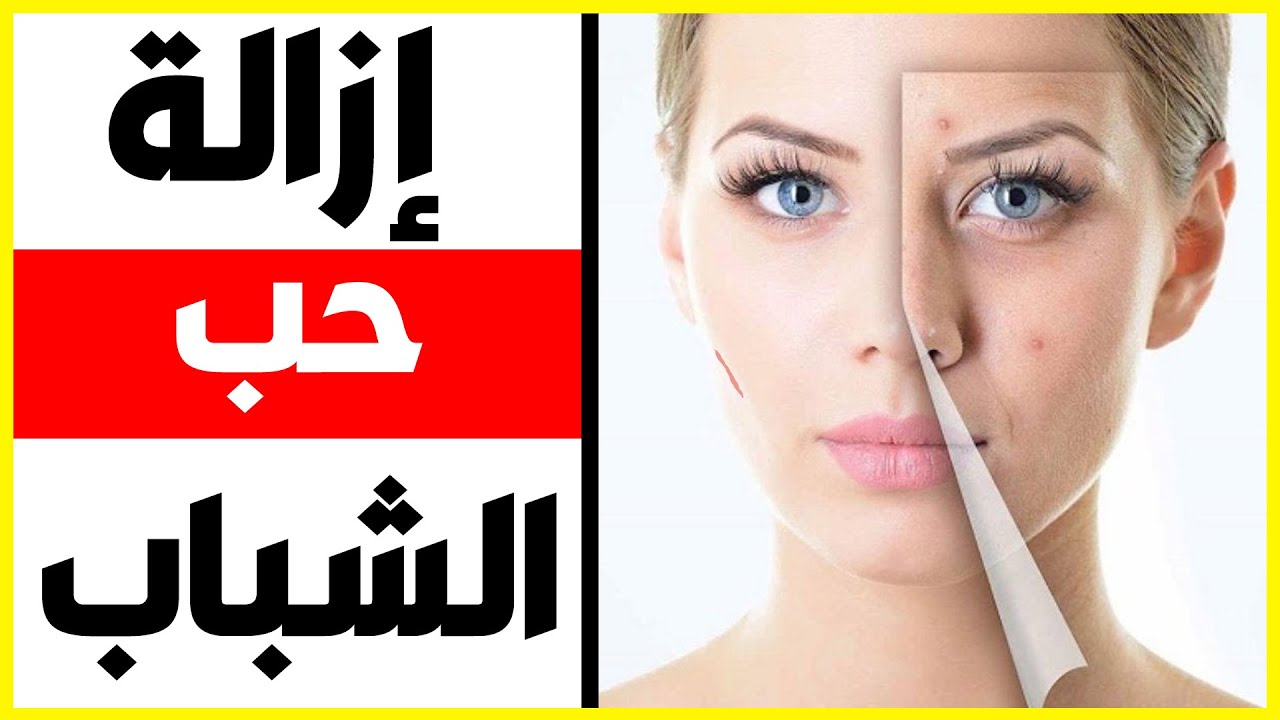 اسعار جلسات الليزر - كيف تكوني جميلة 860 1