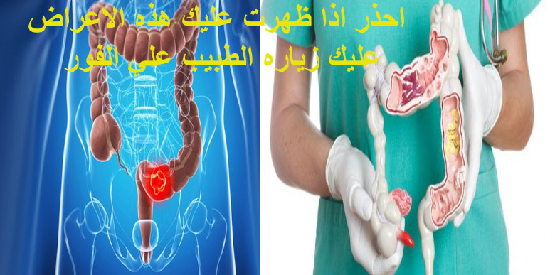 اعراض اعصاب المعدة والقولون , كيف اعرف اني مصابه بالقولون و المعدة