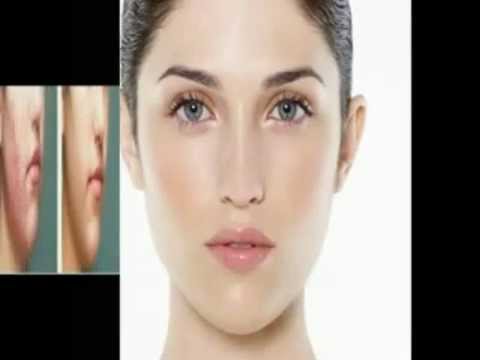 عمليات تجميل الوجه بالليزر - معلومات عن استخدام الليزر في عمليات التجميل 583 3