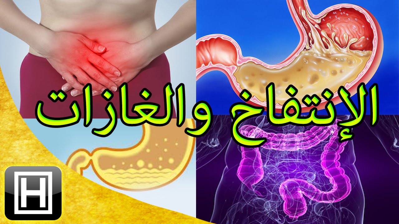 اسباب غازات البطن وعلاجها - معلومات عن غازات البطن و علاجها 1123 1